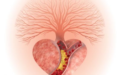 aspirina Antiinflamatoare si aspirina Cardio